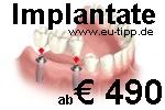 Urlaub Zahnbehandlung - 1 Woche Euro 299 all inclusive