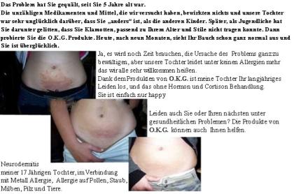 Sie leiden unter Übergewicht Allergien Exzemen oder untern anderen gesundheitl
