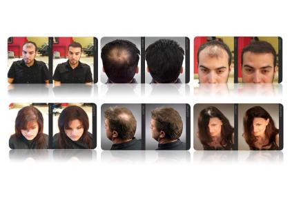 Haarverdichtung Haarauffüllung mit HAIRFOR2 Hollywoods bestgehütetes Geheimnis