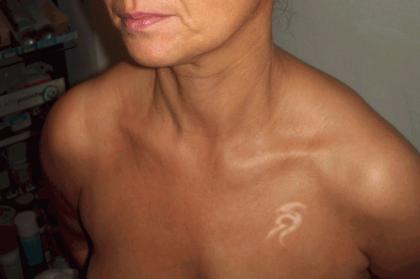 Airbrushtanning / Bräunung ohne UV-Strahlung