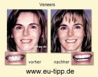 Zahn-Reise nach Tschechien - Euro 179 all inclusive - Implantate Euro 490
